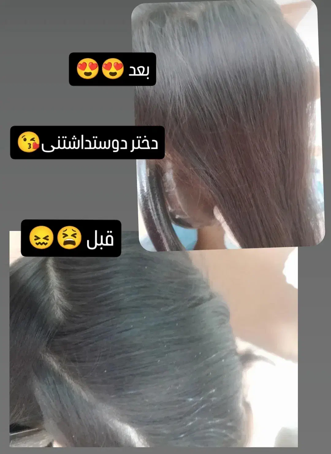 درمان قطعی وتضمینی شپش ورشک|آرایشی، بهداشتی، درمانی|گرگان, |دیوار