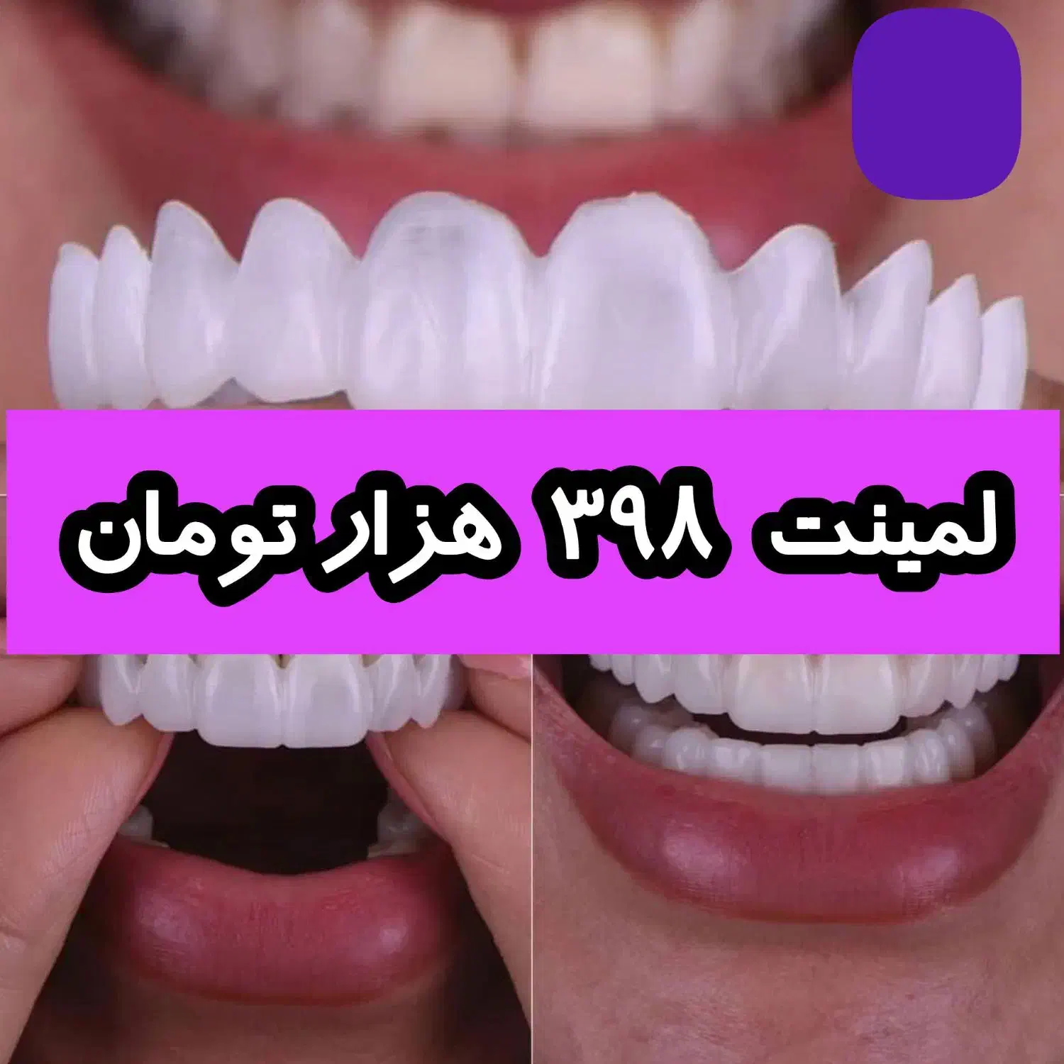 ایتالیایی اصل|تخت و صندلی بچه|جیرفت, |دیوار