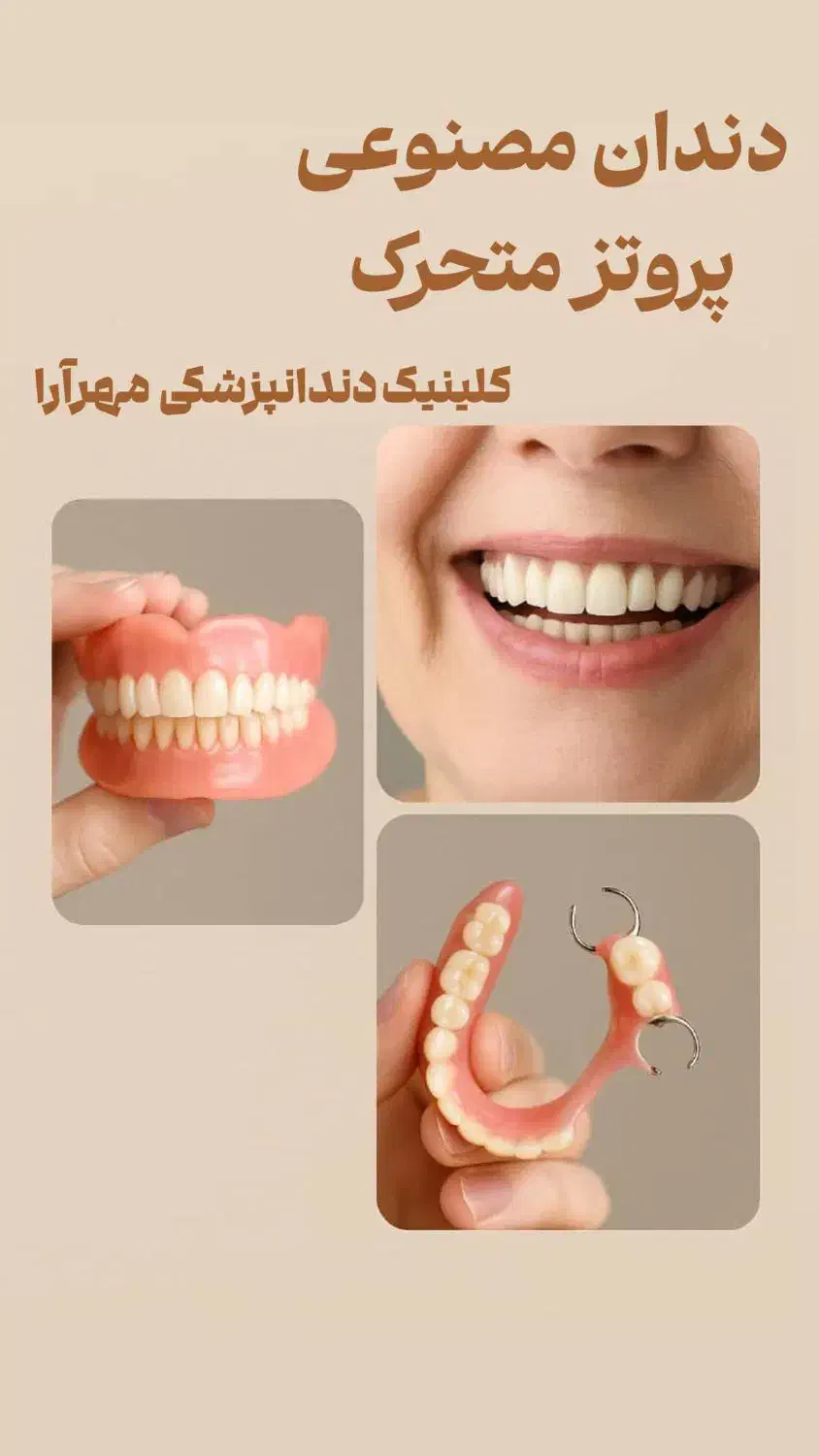 دندان مصنوعی|خدمات آرایشگری و زیبایی|خرمشهر, |دیوار