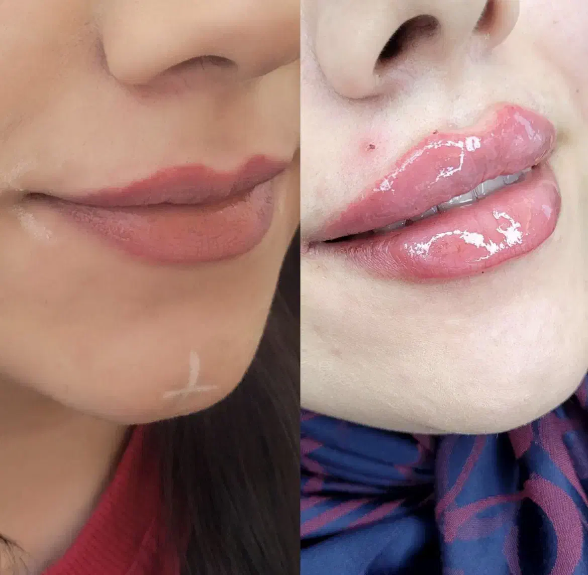 تزریق تخصصی ژل و بوتاکس|خدمات آرایشگری و زیبایی|سبزوار, کوی بهار|دیوار