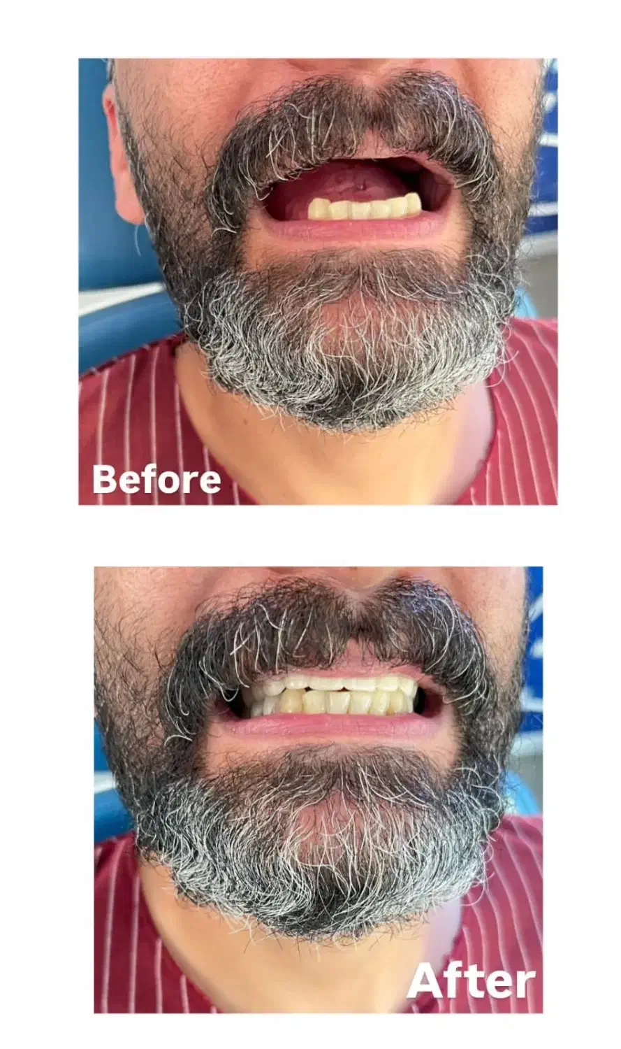 دندان مصنوعی اقساط و بیمه|خدمات آرایشگری و زیبایی|کرمان, |دیوار