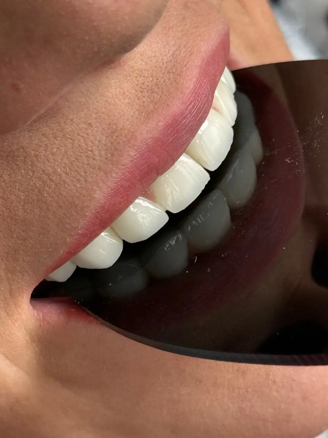 دندانپزشکی با تعرفه یکسال قبل و کیفیت بالا|خدمات زیبایی و سلامت|شیراز, نشاط|دیوار