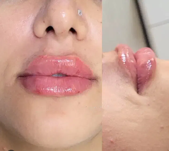 تخفیف تکرارنشدنی|خدمات آرایشگری و زیبایی|رشت, چله خانه|دیوار