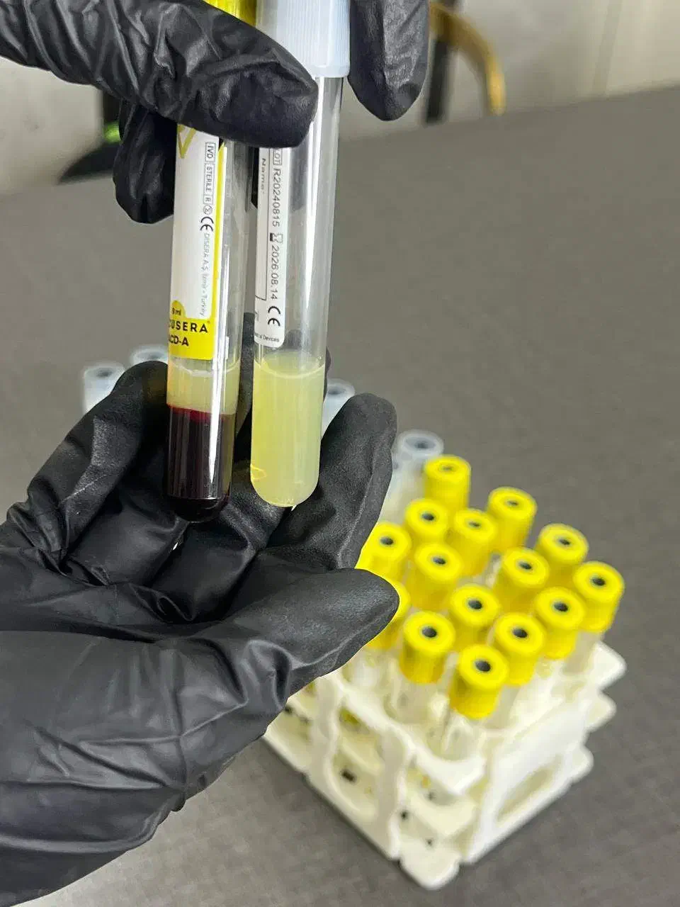 لیزر بوتاکس فیلر|خدمات آرایشگری و زیبایی|مشهد, مشکینی (شهرک غرب)|دیوار