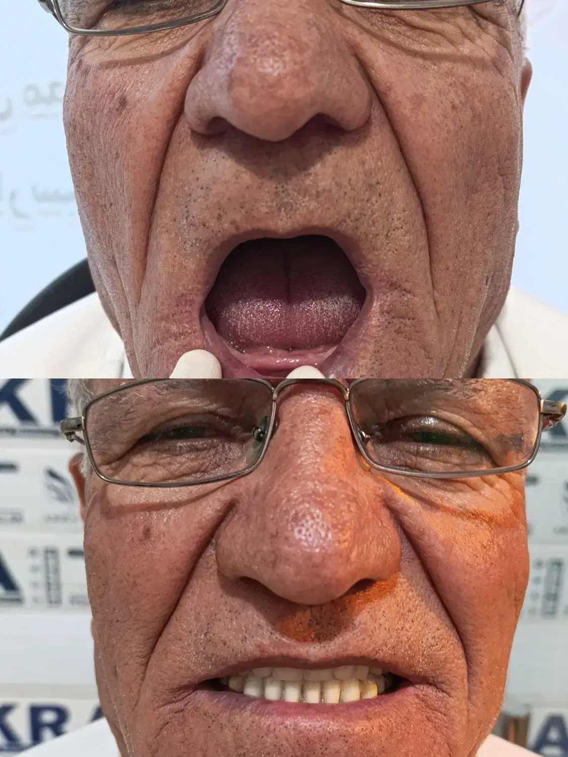 دندان مصنوعی|خدمات آرایشگری و زیبایی|آبیک, |دیوار