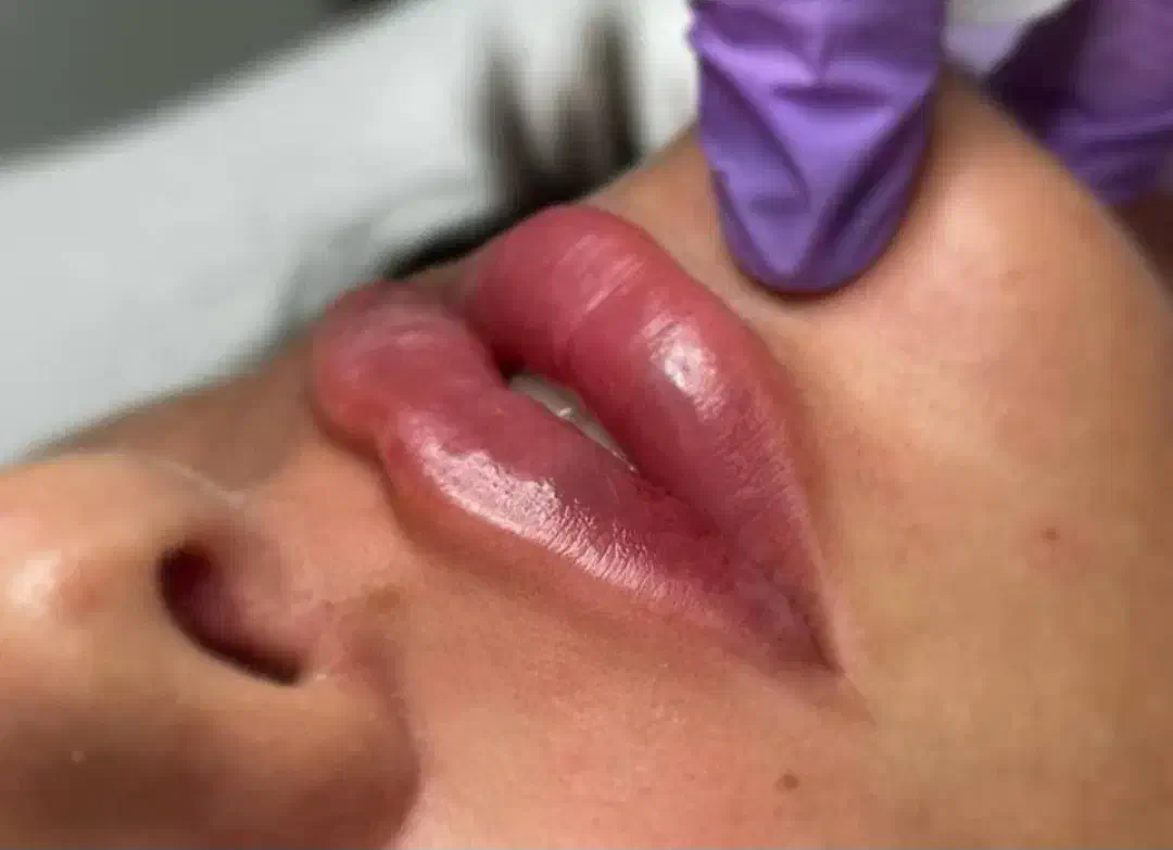 تزریق ژل و بوتاکس و prp صورت و مزو مو|خدمات آرایشگری و زیبایی|سبزوار, جوادیه شرقی|دیوار