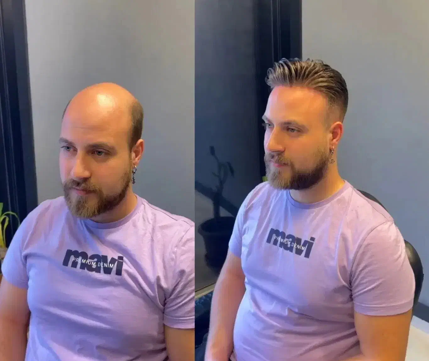 پروتز مو  سنندج|خدمات آرایشگری و زیبایی|سنندج, |دیوار