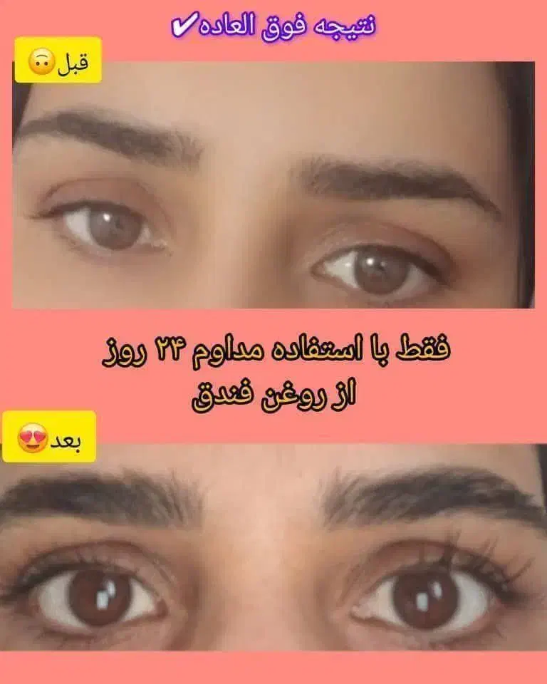 رشد ابرو و مژه 100 درصد|آرایشی، بهداشتی، درمانی|نجفآباد, شهدای غربی|دیوار