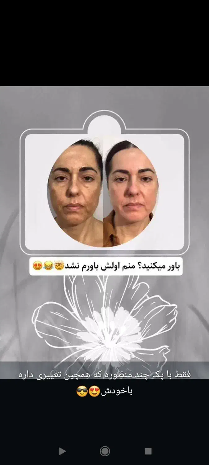 کرم ضدلک گیاهی ژل رویال|آرایشی، بهداشتی، درمانی|اسدآباد, |دیوار