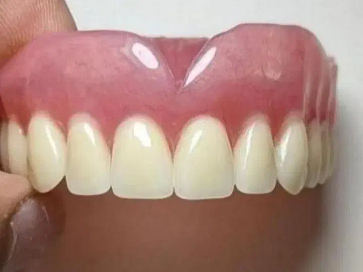 دندان مصنوعی طرح لبخند کامپوزیتی|آرایشی، بهداشتی، درمانی|ارومیه, |دیوار