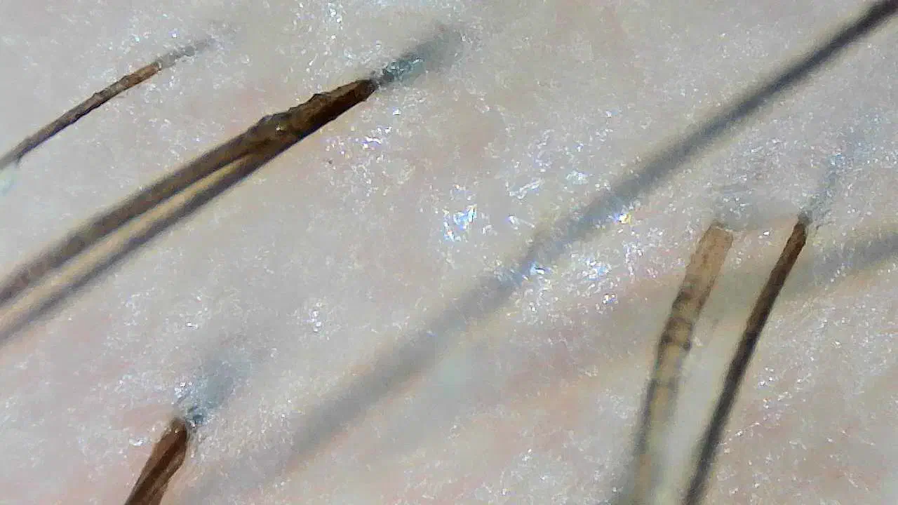 پاکسازی کف سر تخصصی / کراتین و پروتئین|خدمات آرایشگری و زیبایی|اصفهان, کوی ولی عصر|دیوار