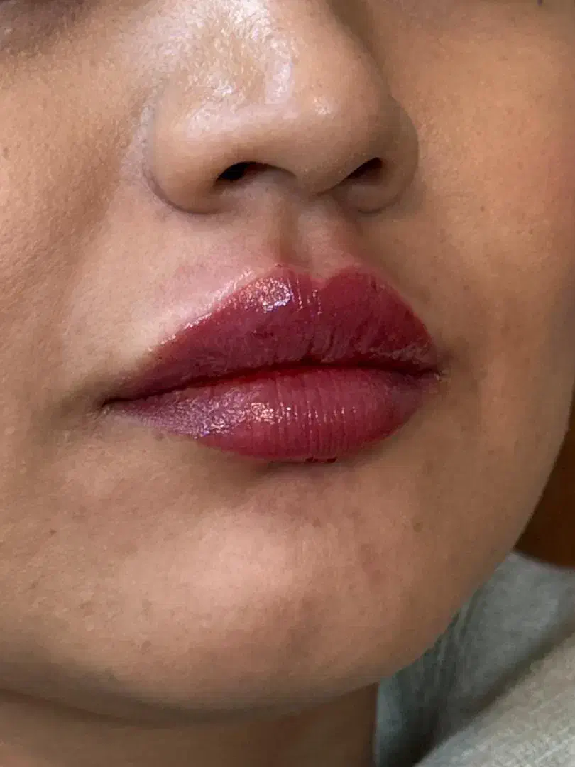 دکتر اکرم آقابیگی پوست مو زیبایی|خدمات آرایشگری و زیبایی|ملایر, |دیوار