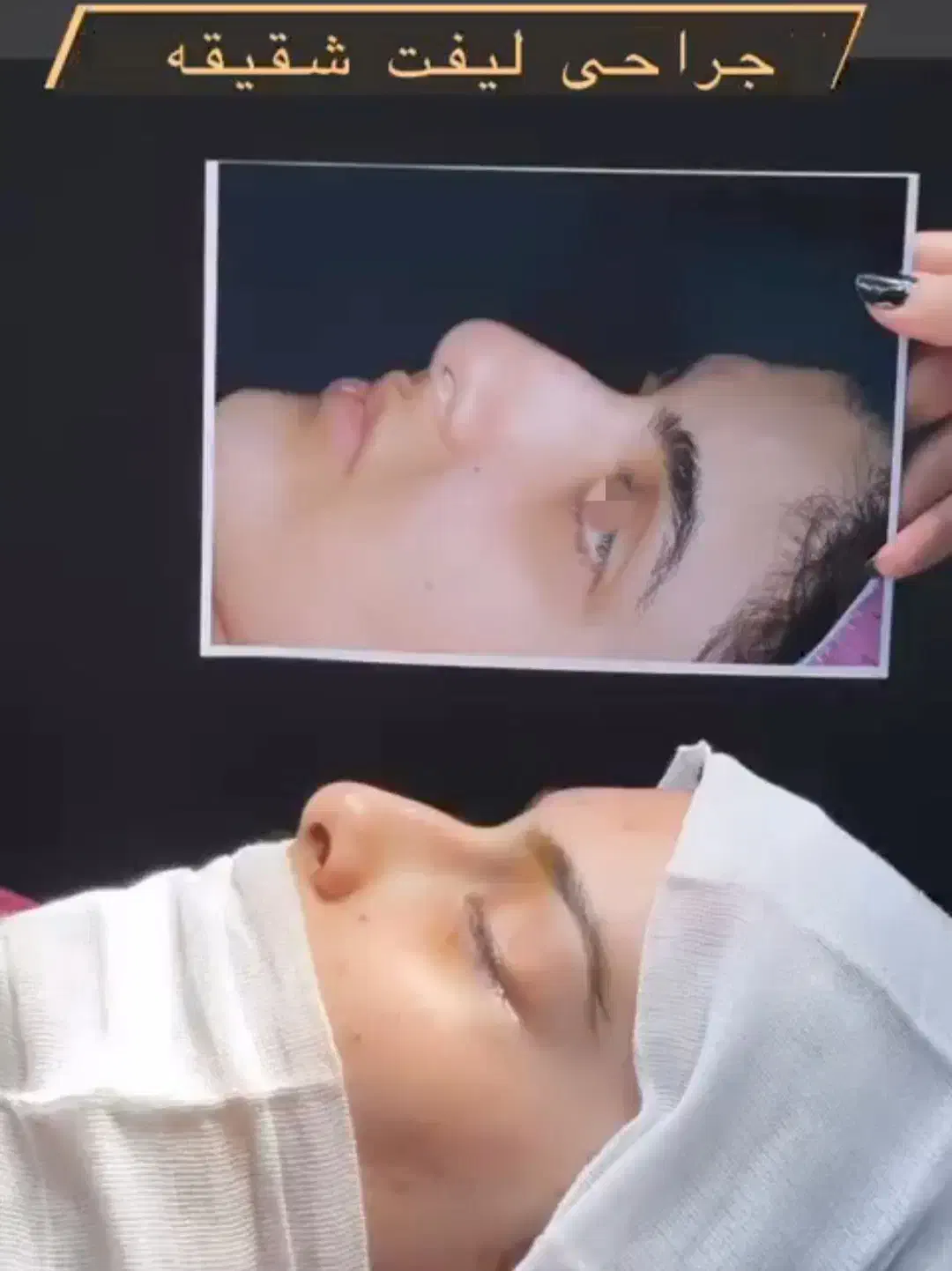 جشنواره بلفارو پلاستی پلک فقط 8500|خدمات آرایشگری و زیبایی|اصفهان, بهار آزادی|دیوار