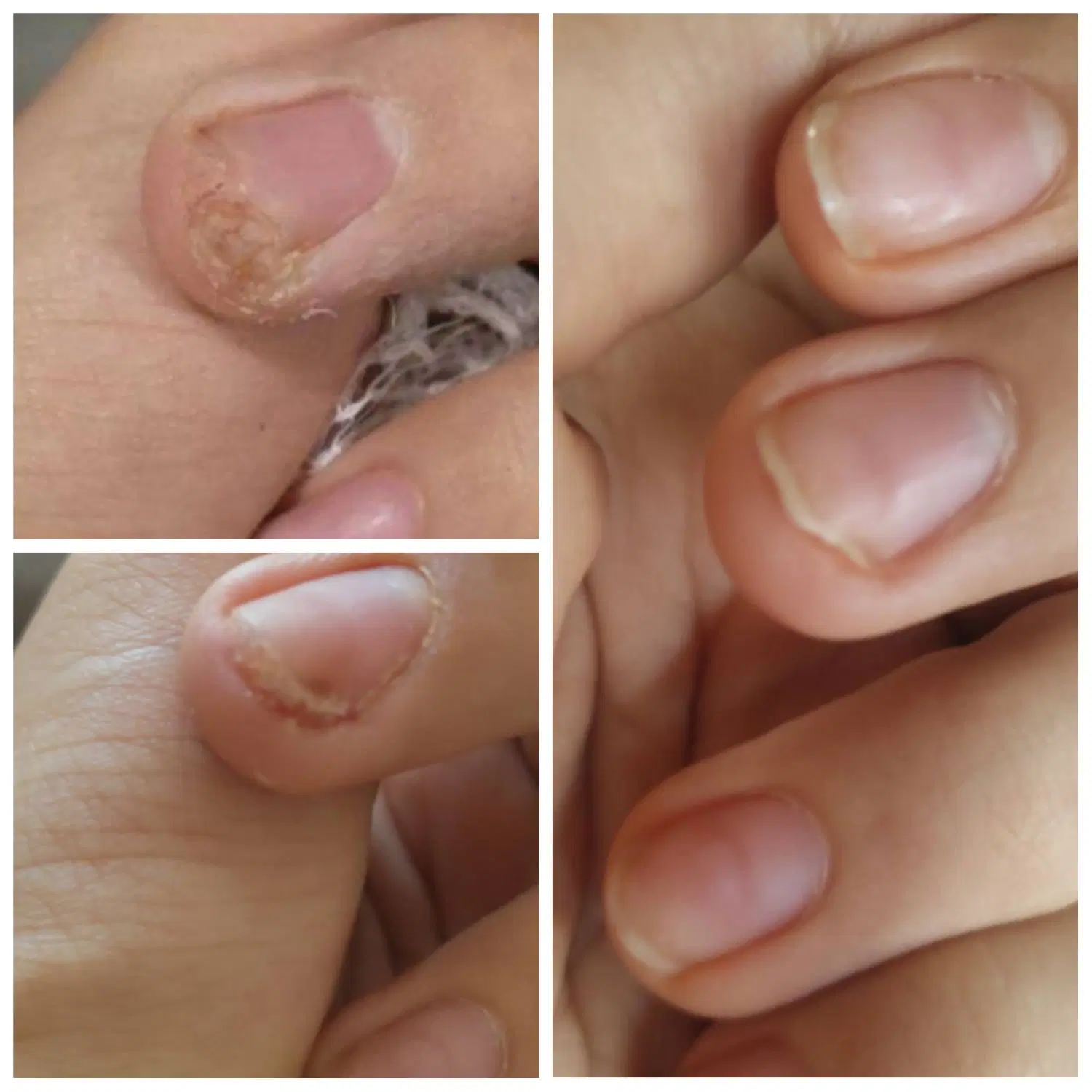 برداشتن خال وزگیل جوانسازی پاک کردن تاتو صورت وبدن|خدمات زیبایی و سلامت|کرمانشاه, |دیوار