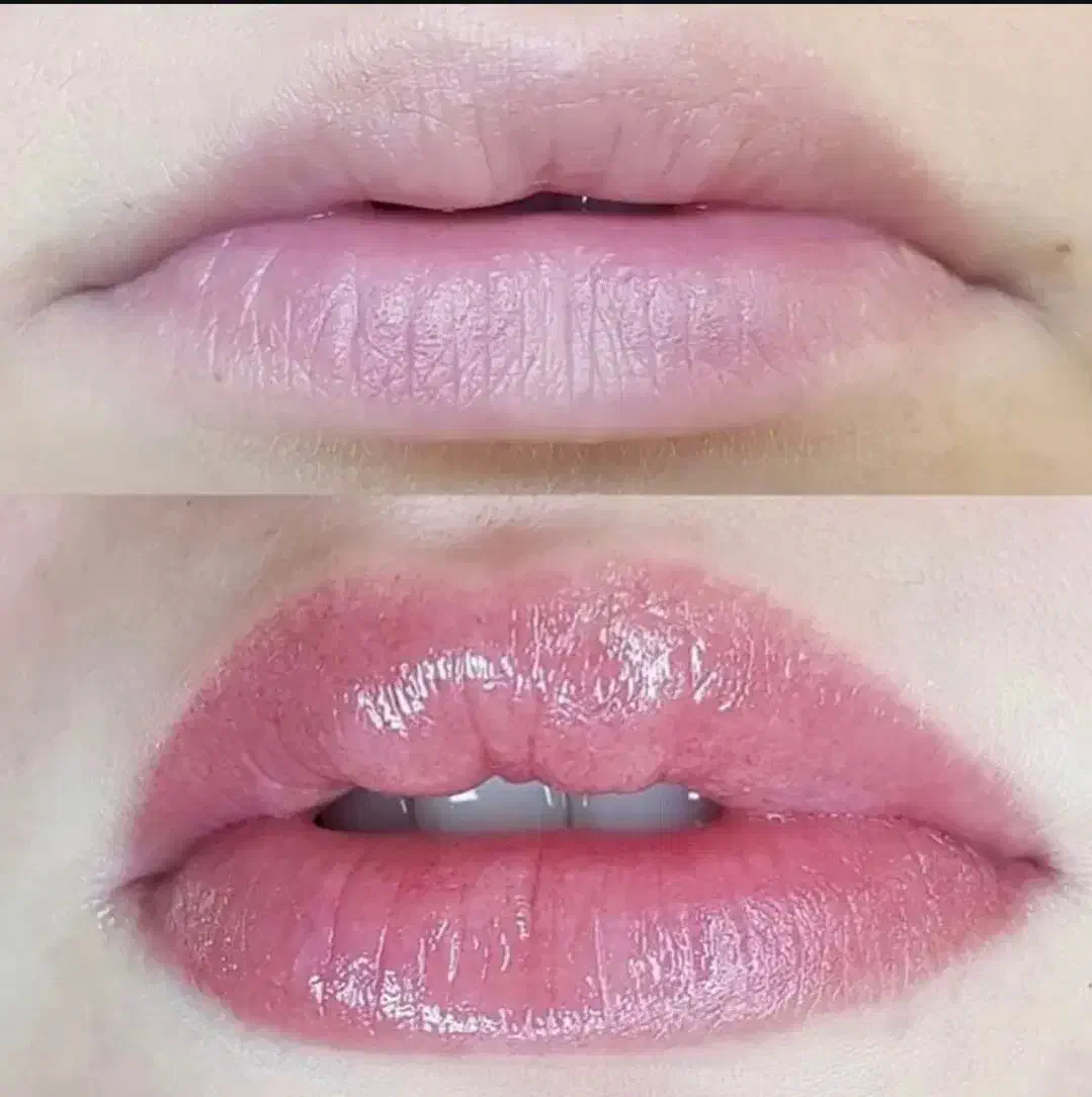 لیپس خارجی|آرایشی، بهداشتی، درمانی|گرگان, |دیوار