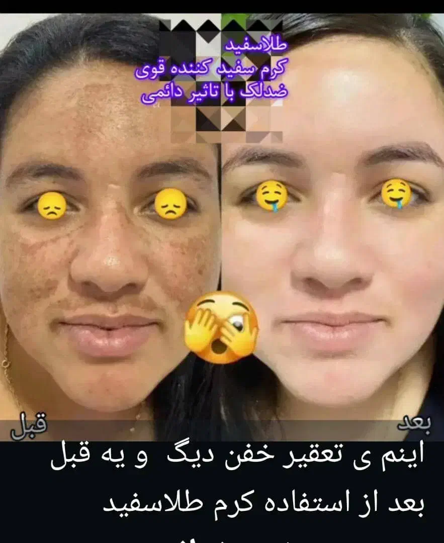 کرم شب|آرایشی، بهداشتی، درمانی|قم, شاه ابراهیم|دیوار