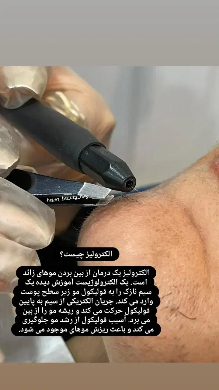 ژل وبوتاکس|خدمات آرایشگری و زیبایی|اهواز, پردیس دو|دیوار