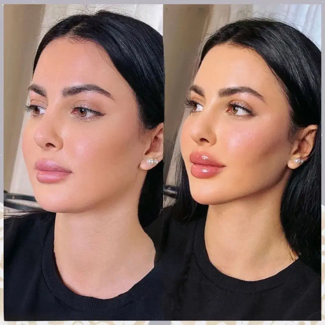 کلینیک پوست زعفرانیه نسل جدید بوتاکس گازی نخ فیلر|خدمات آرایشگری و زیبایی|تهران, زعفرانیه|دیوار