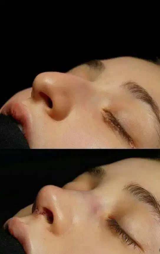 جراحی عمل بینی/لیپو ابدو/بلفارو/لیفت/لیپو ساکشن|خدمات آرایشگری و زیبایی|تهران, فلسطین (میدان انقلاب)|دیوار