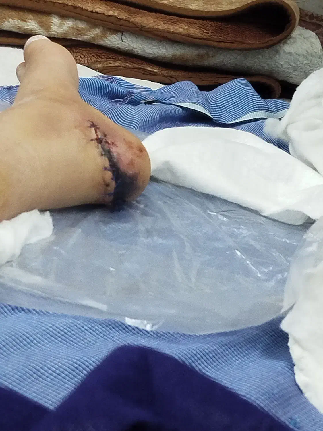 کبوتر گمشده|حیوانات|ایرانشهر, |دیوار