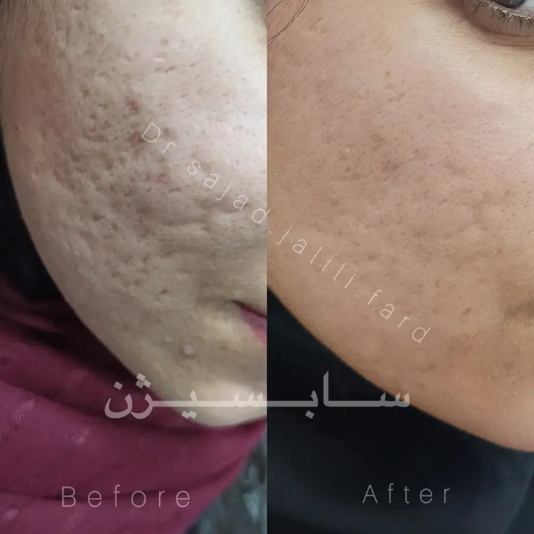 خدمات زیبایی دکتر سجاد جلیلی فرد|خدمات آرایشگری و زیبایی|مسجد سلیمان, |دیوار