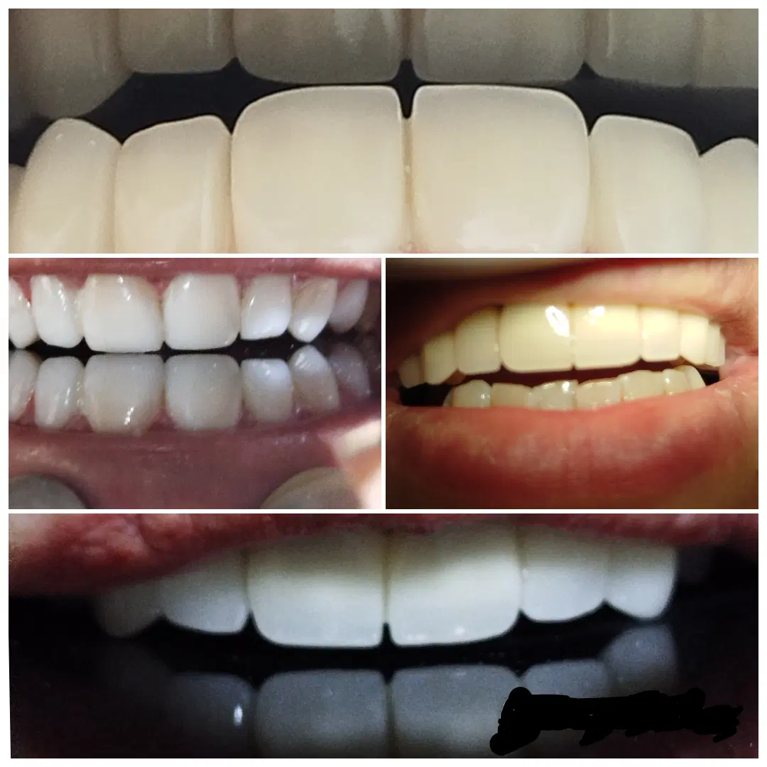 خدمات دندانپزشکی و دندانسازی مستر دنت (اقساط)|خدمات زیبایی و سلامت|ارومیه, |دیوار