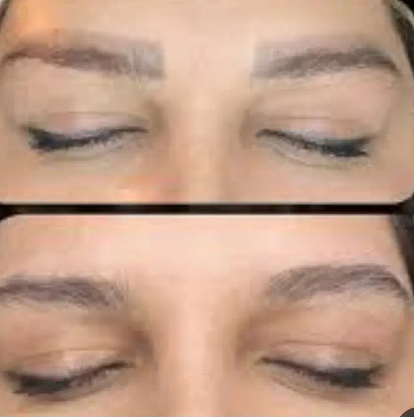 پاک کردن تتو با اسید میوه با بهترین مواد|خدمات آرایشگری و زیبایی|دماوند, دماوند|دیوار