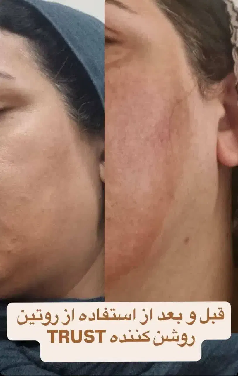 روتین پوستی مهلران|خدمات آموزشی|احمدآبادمستوفی, |دیوار