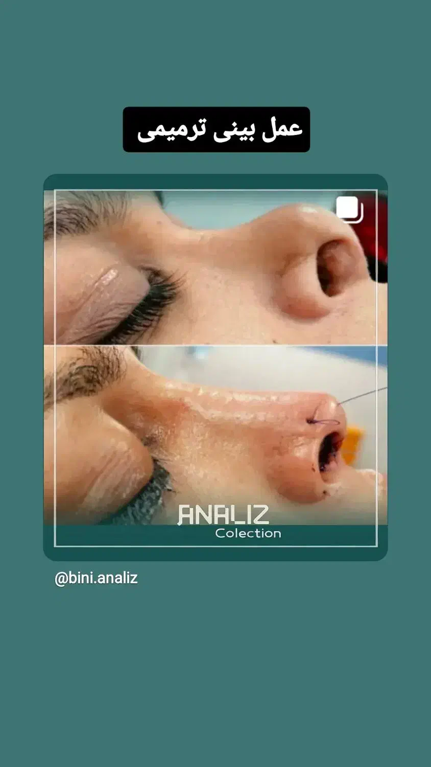 عمل بینی/لیزر co2/پلک/لیپوساکشن/غبغب|خدمات آرایشگری و زیبایی|شیراز, قصرالدشت|دیوار