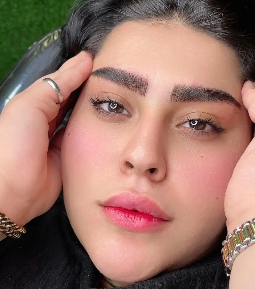 مرکز تخصصی فیبروز به سبک (هایپر نچرال وموی)|خدمات زیبایی و سلامت|کرمانشاه, |دیوار