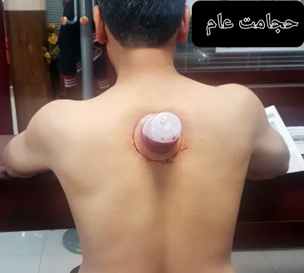 خدمات پرستاری وطب سنتی|خدمات آرایشگری و زیبایی|خوی, |دیوار