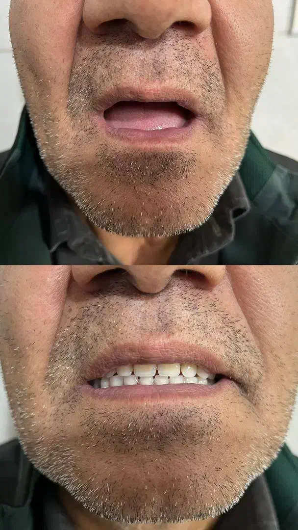 دندانسازی محلات|خدمات آرایشگری و زیبایی|محلات, |دیوار