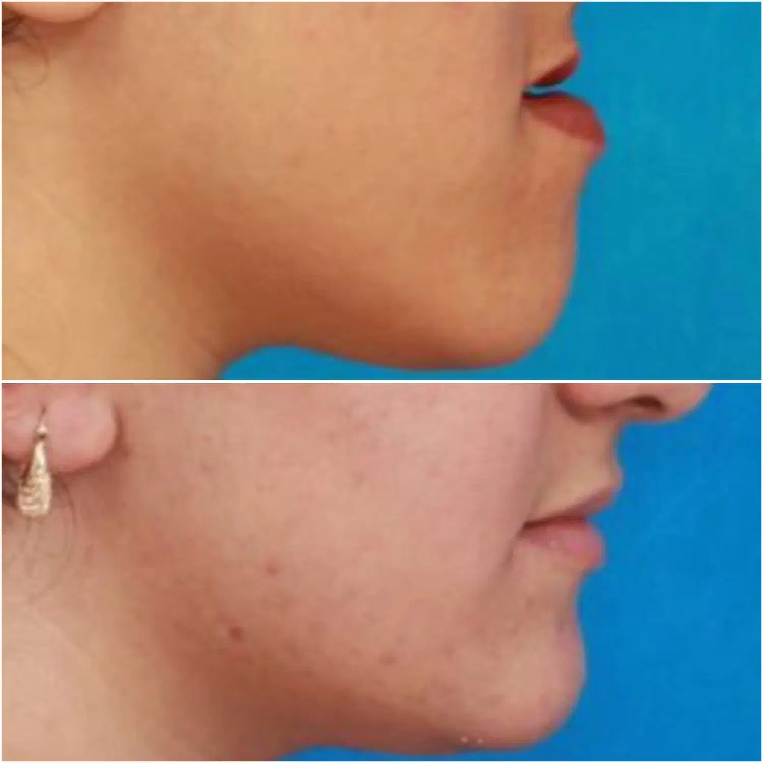 اورتودنسی دندان/۱۰م تخفیف/اقساط بدون سود|خدمات آرایشگری و زیبایی|فسا, |دیوار