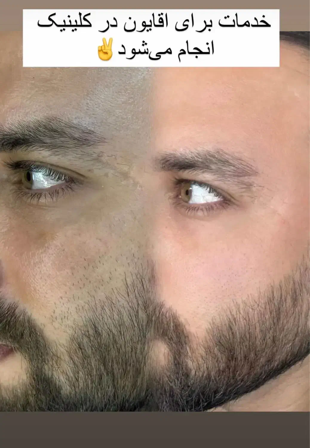 پوست روشن را از ما بخواهید|خدمات آرایشگری و زیبایی|رشت, گلسار|دیوار