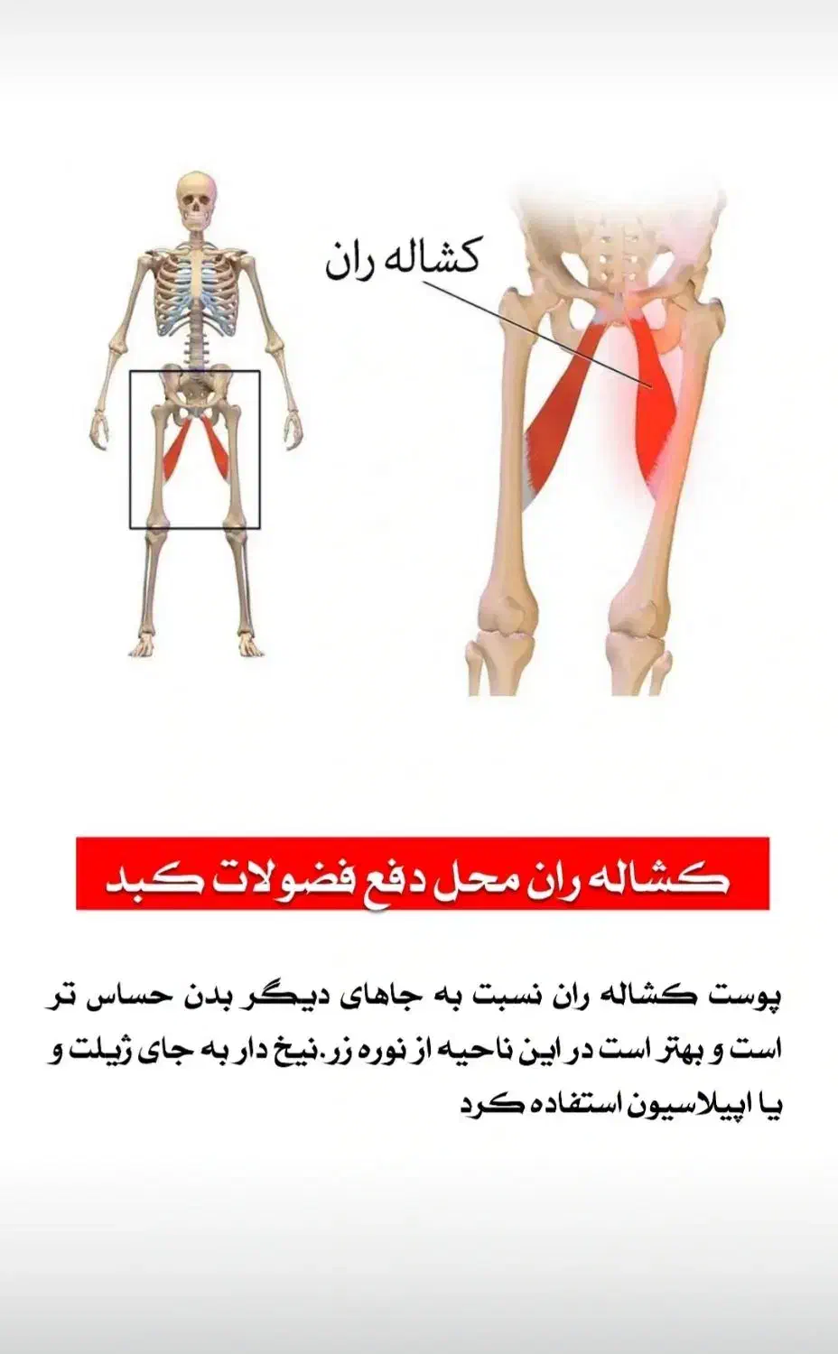 نوره زرنیخ دار|آرایشی، بهداشتی، درمانی|خاش, |دیوار