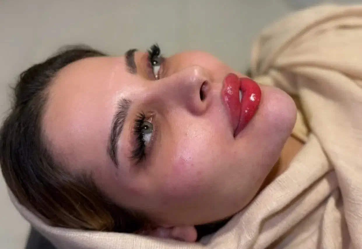 تزریق ژل لب بوتاکس مزو انزیم کانتورینگ لیفت صورت|خدمات آرایشگری و زیبایی|تهران, باغ فیض|دیوار