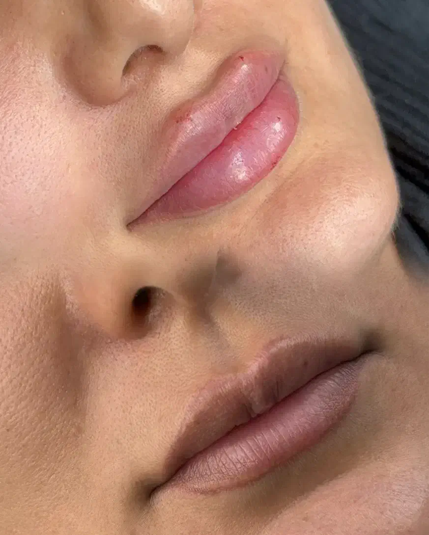 تزریقات زیبایی کلینیک زیبایی لاراتیس|خدمات آرایشگری و زیبایی|یاسوج, |دیوار