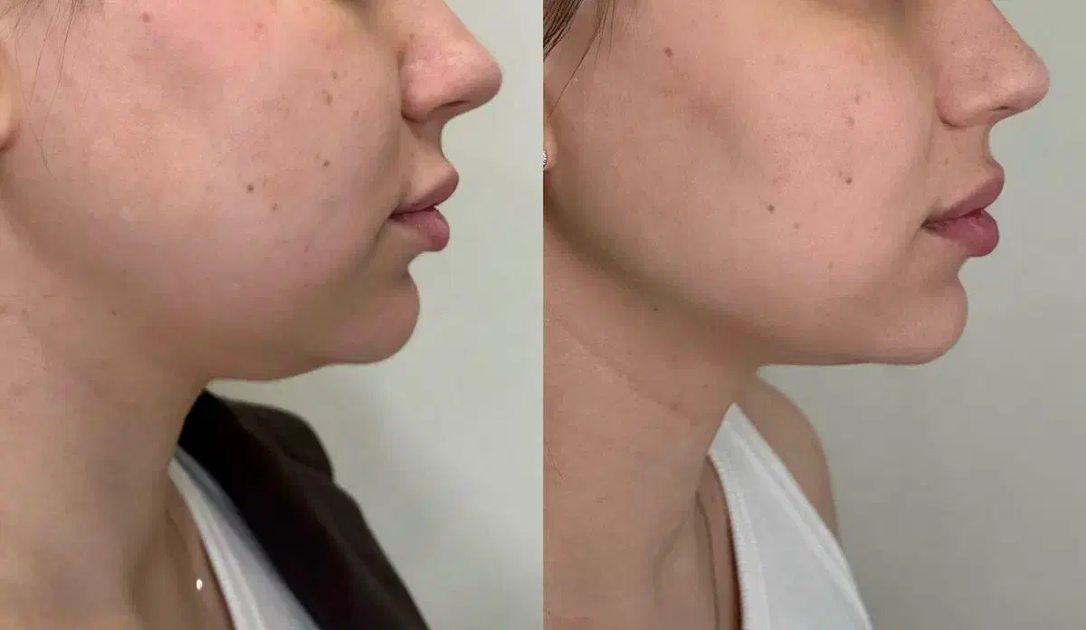 یلدا خوش اندام شودستگاه های لاغری مطب فارابی|خدمات آرایشگری و زیبایی|رشت, سعدی (تختی)|دیوار