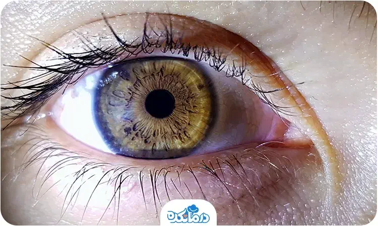 چشم پزشک محلی|فعالیت داوطلبانه|ایلام, |دیوار