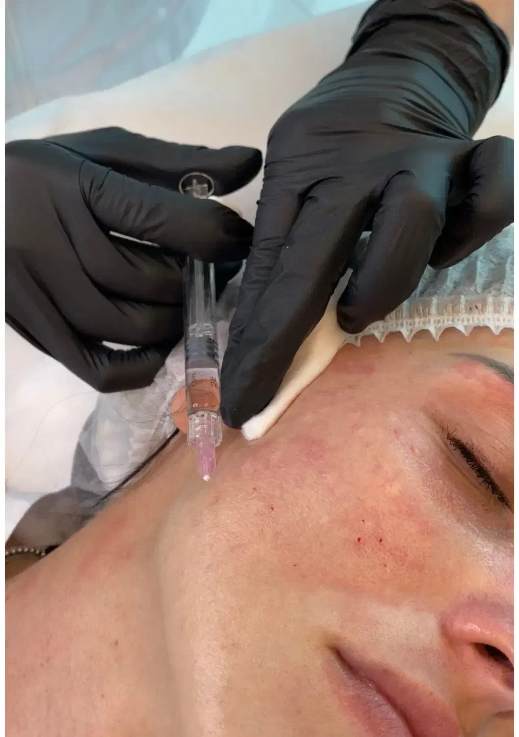 ژل بوتاکس مزوتراپی جوانساز فشیال پاکسازی|خدمات آرایشگری و زیبایی|اندیشه, اندیشه فاز ۱|دیوار