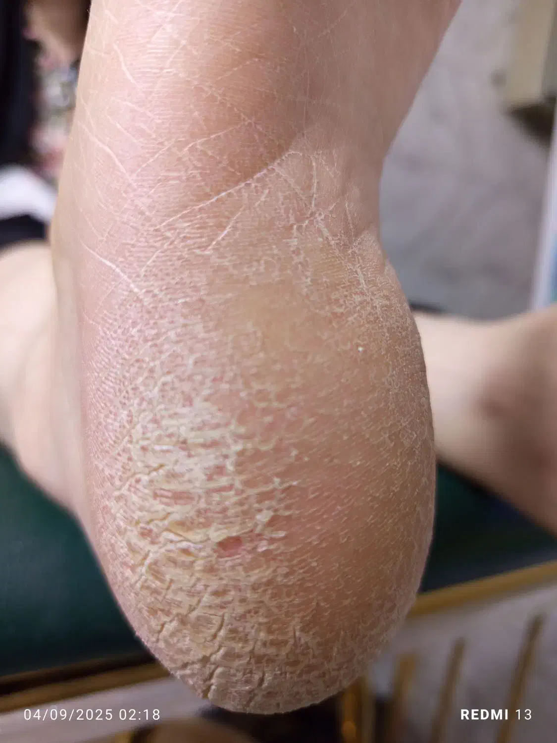 کفسابی و پدیکور پا بصورت تخصصی مخصوص بانوان|خدمات آرایشگری و زیبایی|اسلامشهر, شهرک امام حسین (میان آباد)|دیوار