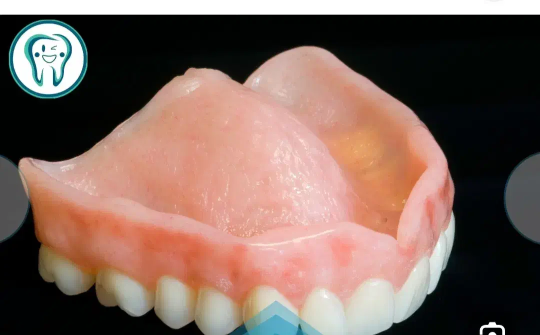 گمشده دندان متحرک سردزک شاهچراغ|اشیا|شیراز, لب آب|دیوار