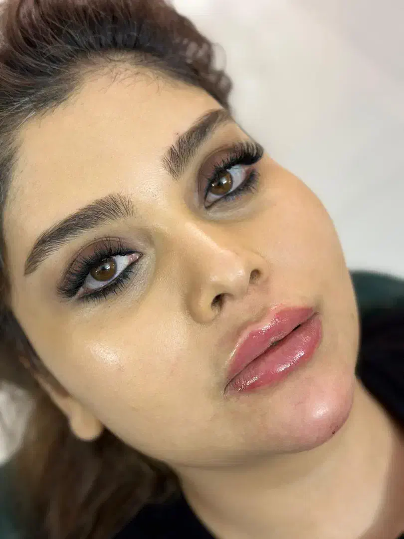 خدمات ژل وبوتاکس و دیگر خدمات زیبایی|خدمات آرایشگری و زیبایی|مشهد, ایثار|دیوار