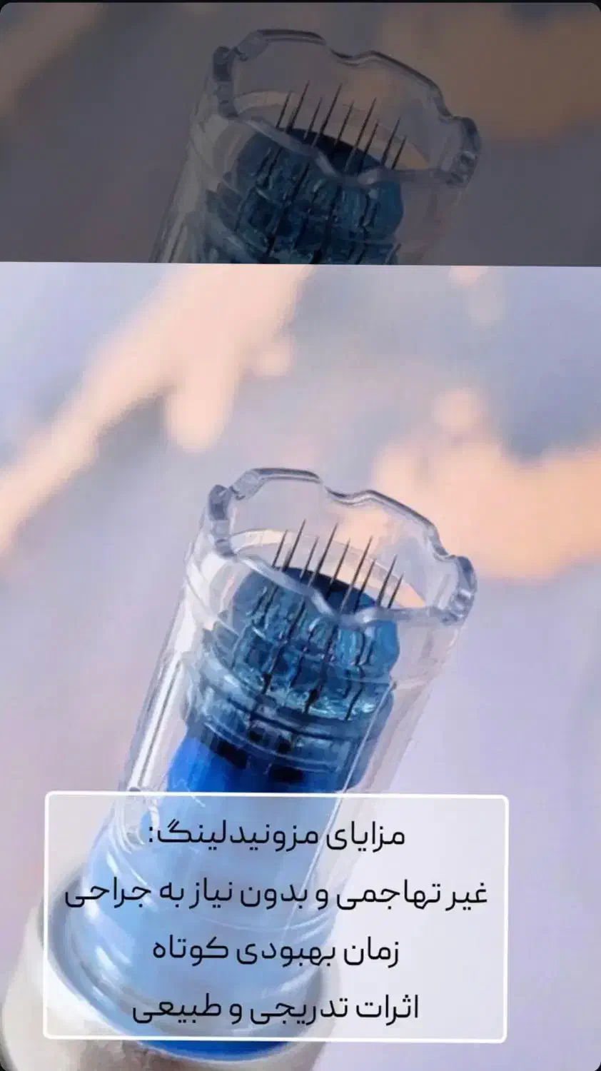 مزونیدلینگ حرفه‌ای در کلینیک زیبایی/هاشمیه|خدمات آرایشگری و زیبایی|مشهد, چهارچشمه|دیوار