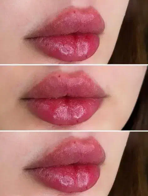 تزریق ژل و بوتاکس .کانتوریگ صورت .زاویه سازی|خدمات آرایشگری و زیبایی|بروجن, |دیوار