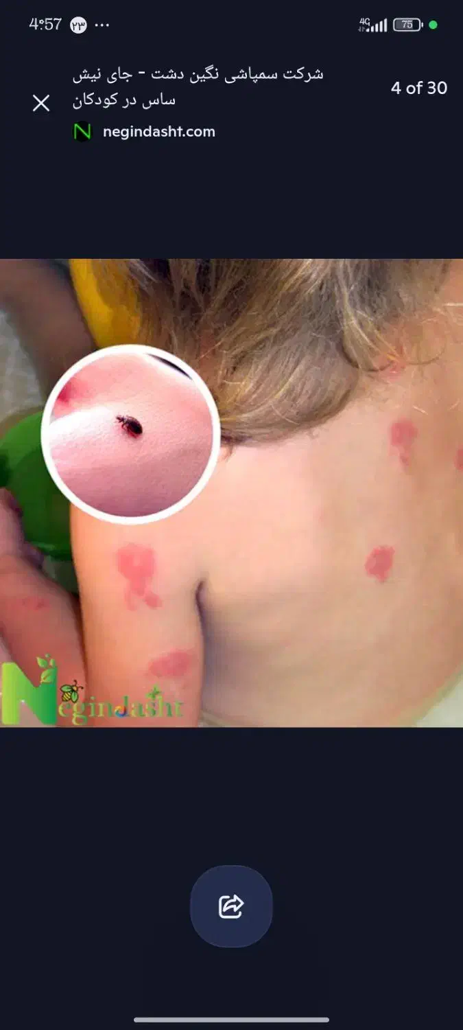 خدمات سمپاشی %100تضمینی تمام نقاط تهران|خدمات نظافت|تهران, آهنگ|دیوار