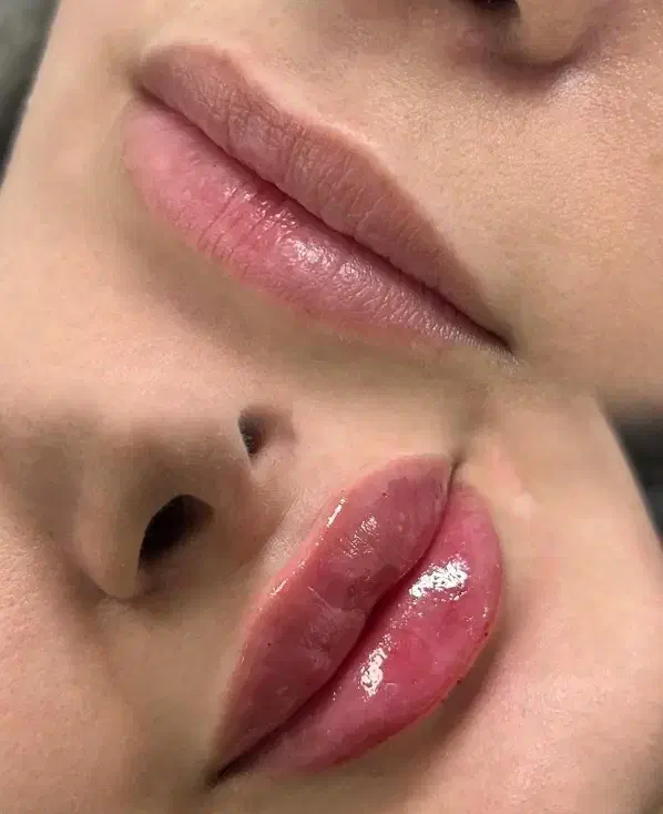 آف ژل بوتاکس مناسبت روز زن|خدمات آرایشگری و زیبایی|ایذه, |دیوار