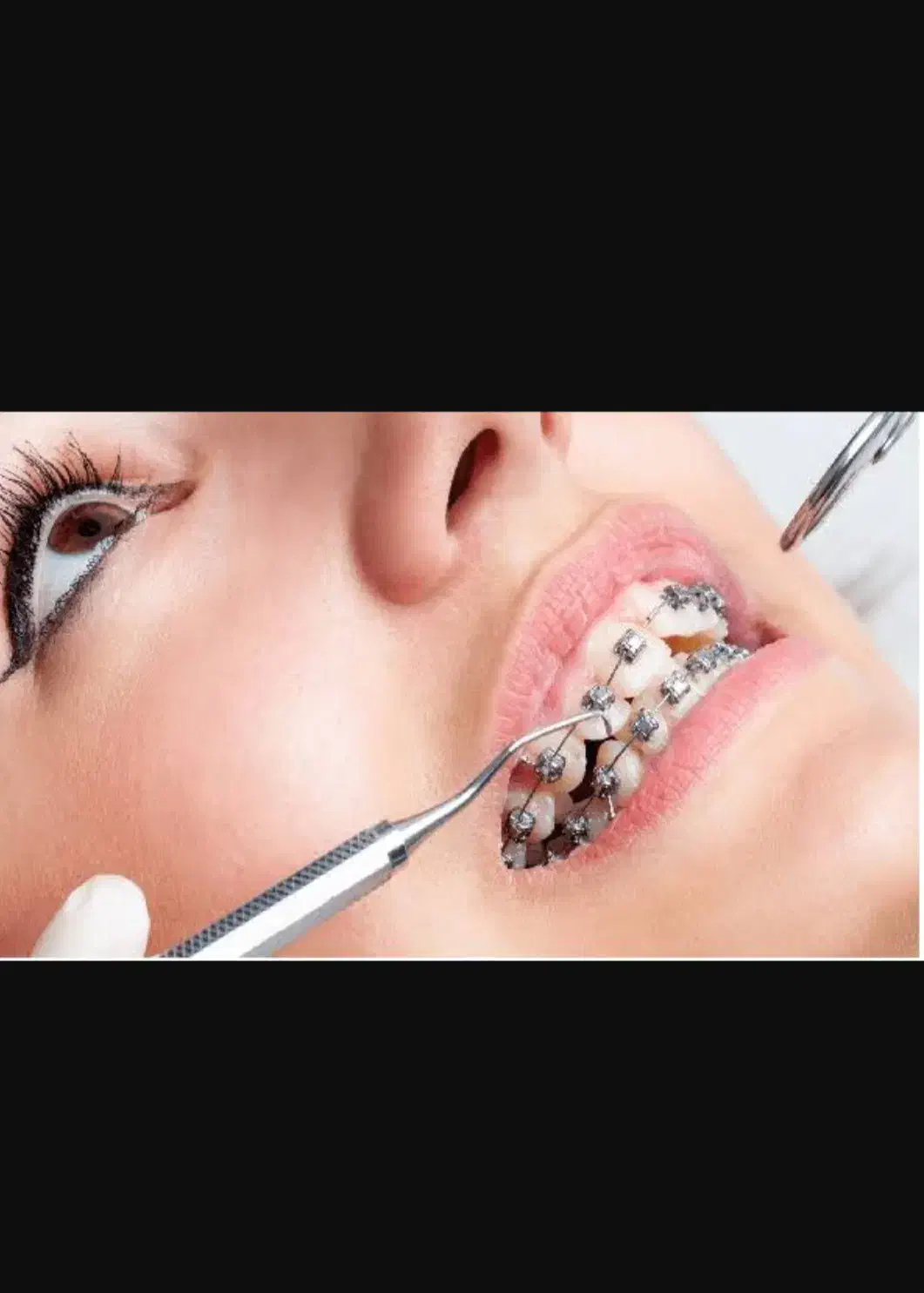 راهنمای ارتودنسی دندان|فعالیت داوطلبانه تحقیقاتی|بیرجند, |دیوار