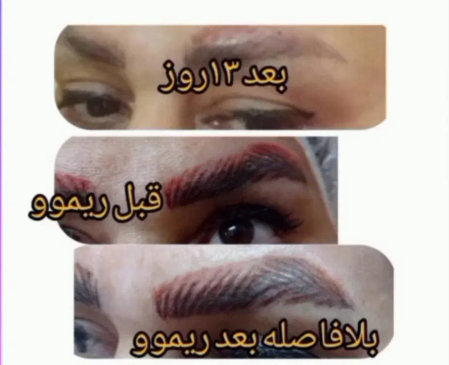 خدمات و آموزش میکرو پیگمنتیشن،میکرو بلیدینگ،ریموو|خدمات آرایشگری و زیبایی|گرگان, |دیوار