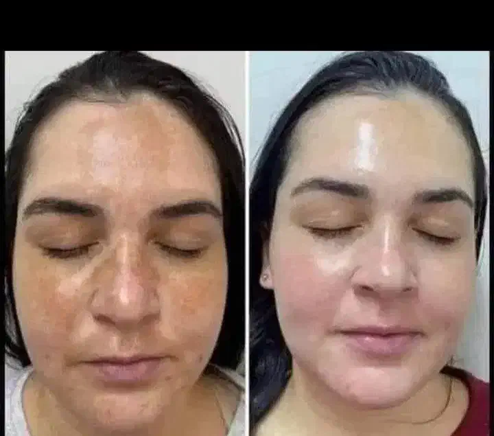 نمایندگی اصلی ضدلک لاکچری کوین|آرایشی، بهداشتی، درمانی|پاکدشت, پاکدشت (مامازند)|دیوار